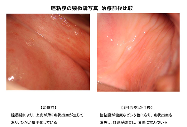 膣粘膜の顕微鏡写真